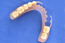 Metal-Free Partial Dentures