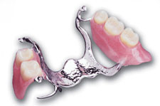 Partial Dentures